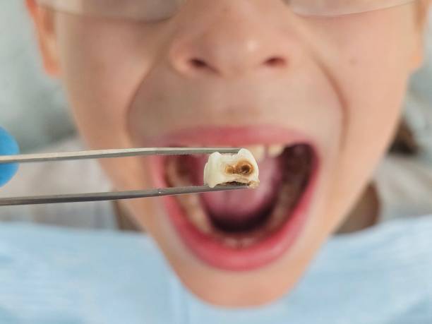 Professional Emergency Dental Service in MS
